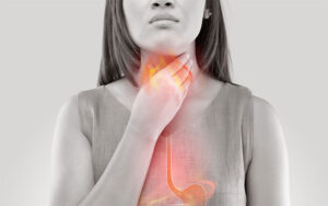 Read more about the article Acid Reflux … what to do ?