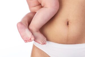 Read more about the article Postpartum  Weight  loss